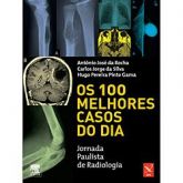 OS 100 MELHORES CASOS DO DIA - 2010