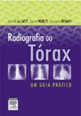 RADIOGRAFIA DO TORAX - 2010