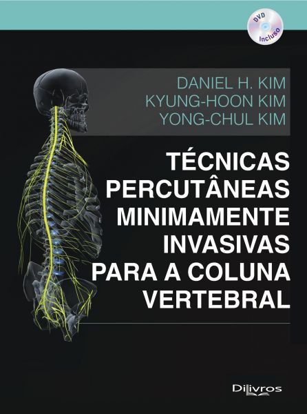 TÉCNICAS PERCUTÂNEAS MINIMAMENTE INVASIVAS PARA COLUNA VERTE