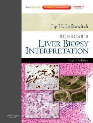 SCHEUER'S LIVER BIOPSY INTERPRETATION