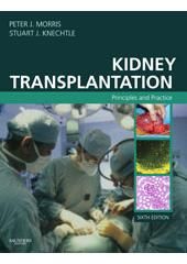 KIDNEY TRANSPLANTATION, PRINCIPLES AND PRACTICE - 6 ª ED