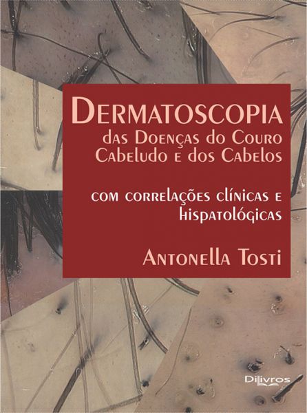 DERMATOSCOPIA DAS DOENÇAS DO COURO CABELUDO E DOS CABELOS -