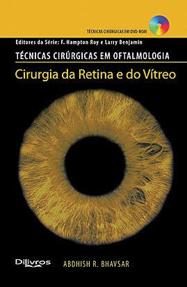 CIRURGIA DA RETINA E DO VÍTREO - TÉCNICAS CIRÚRGICAS EM OFTA