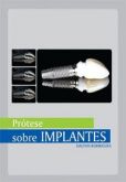 PRÓTESE SOBRE IMPLANTES - PASSOS CLÍNICOS E LABORATORIAIS -