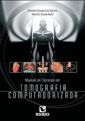 MANUAL DE TÉCNICAS EM TOMOGRAFIA COMPUTADORIZADA - 2009