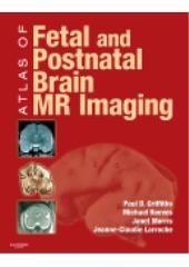 ATLAS OF FETAL AND POSTNATAL BRAIN MR IMAGING - 2010