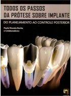 TODOS OS PASSOS DA PRÓTESE SOBRE IMPLANTES - 2012