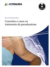 CONCEITOS E CASOS NO TRATAMENTO DA PSEUDOARTROSE - 2014